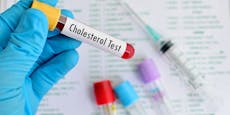 Österreich hat ein großes Cholesterinproblem – und du?