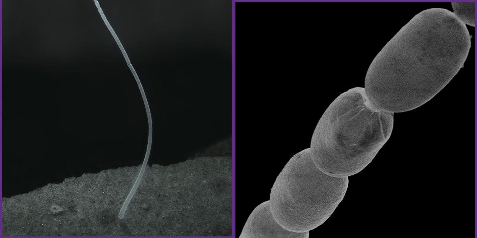 Thiomargarita magnifica kann bis zu zwei Zentimeter groß werden – riesig für ein Bakterium.