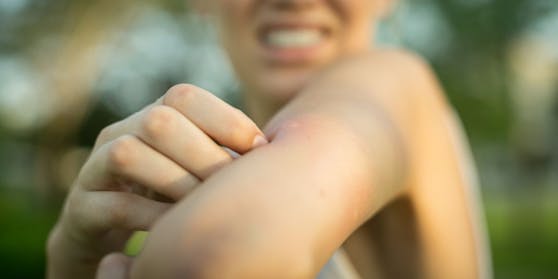 Kleine Insekten können tatsächlich einen erheblichen Abdruck auf deiner Haut hinterlassen. Wenn du nicht achtsam genug bist können die Schwellungen und Schmerzen intensiver werden und sich gar entzünden.