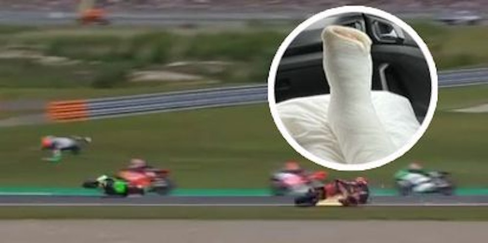 Joel Kelso wird durch die Luft geschleudert. Das Ergebnis: ein Gipsbein.