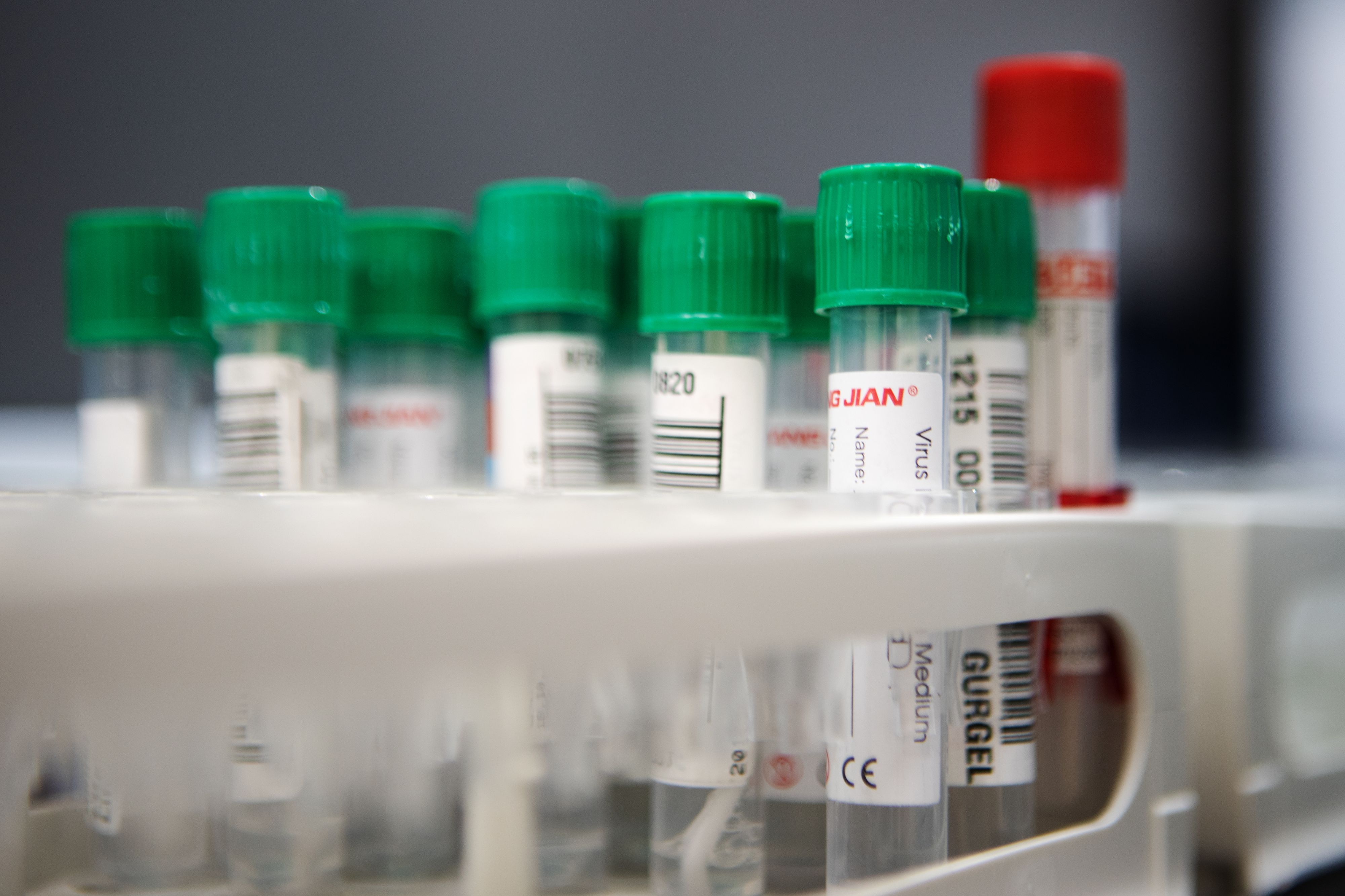 Download von www.picturedesk.com am 07.07.2022 (15:24).  ÖSTERREICH; WIEN; 20201215; Corona Virus (Covid-19) Proben in einem Laborgerät , fotografiert in Wien am 15 Dezember 2020. Die Lifebrain Group hat heute das, nach eigenen Angaben modernste und grösste PCR und Antigentest Labor in Österreich mit einer Kapazität von 30 000 Proben am 'Tag, eröffnet. /// AUSTRIA; VIENNA; 20201215; Corona virus (Covid-19) samples in a laboratory device, photographed in Vienna on December 15, 2020. The Lifebrain Group has what it claims to be the most modern and largest PCR and antigen test laboratory in Austria with a capacity of 30,000 rehearsals on the 'day. - 20201215_PD2284 - Rechteinfo: Rights Managed (RM)