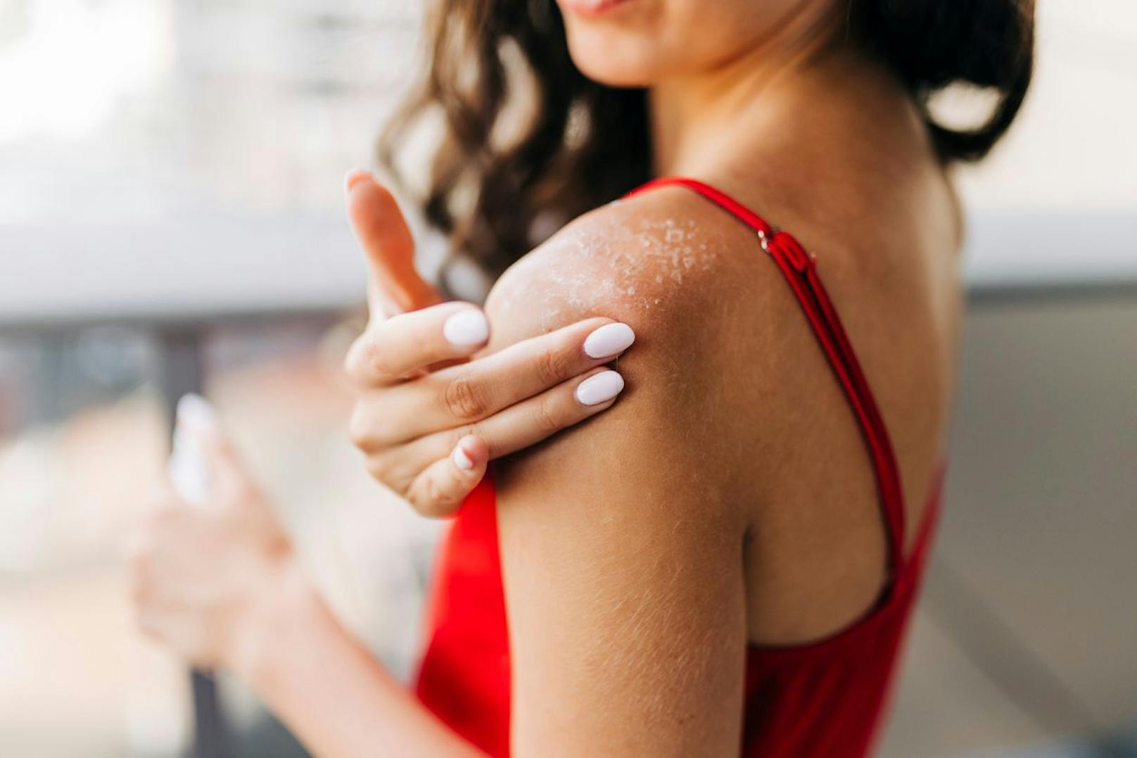 Make-Up und weitere Kosmetika können deine Haut reizen. Vermeide diese lieber für eine Weile, da ihre Inhaltsstoffe viel Schaden anrichten können.