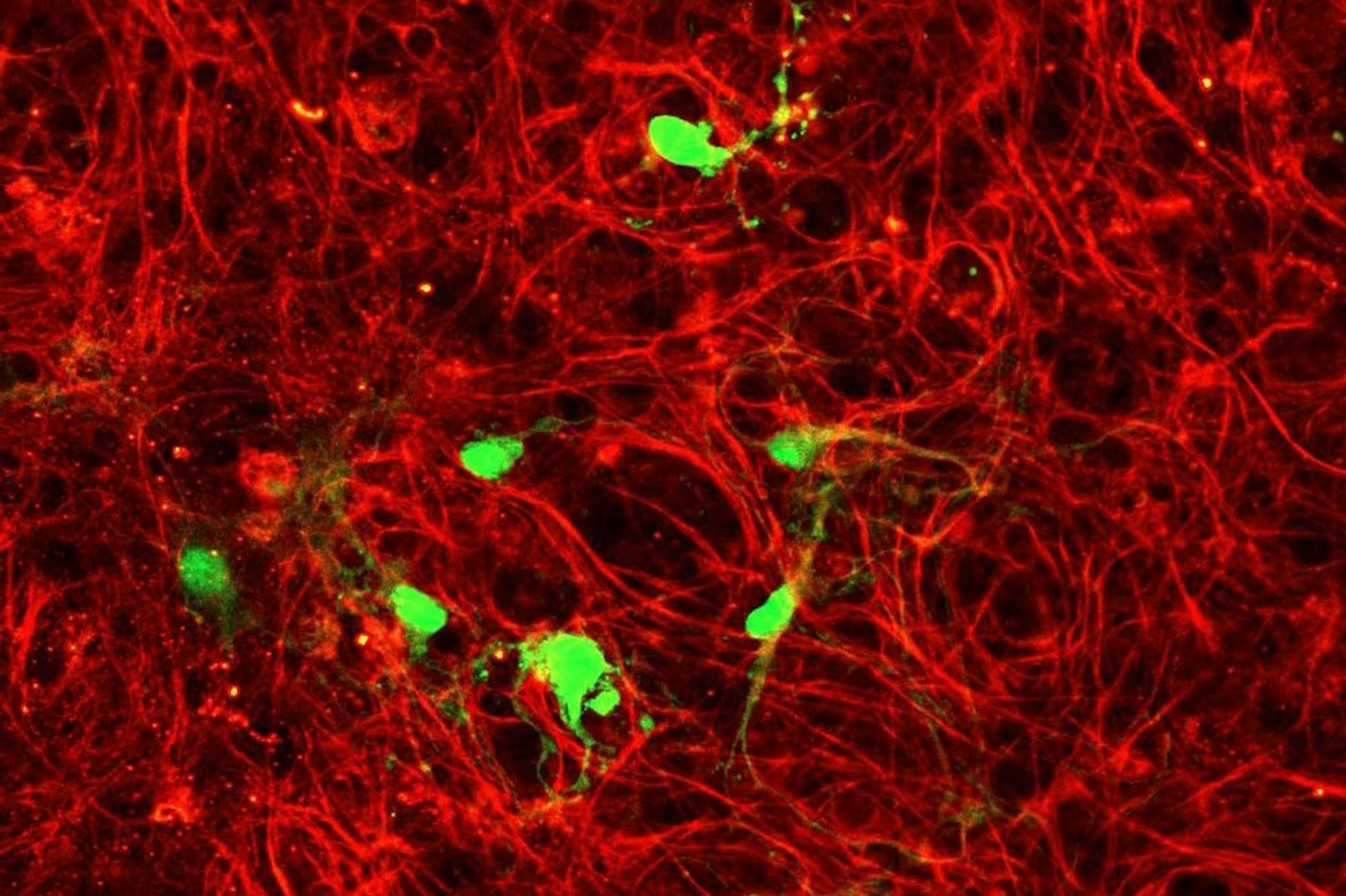 Immunzellen, die mit einem Typ von Adeno-assoziiertem Virus (AAV9) infiziert sind. Das Virus trägt genetisches Material, das die infizierten Mikroglia-Immunzellen im Gehirn dazu bringt, ein grün fluoreszierendes Protein zu produzieren. Der rote Farbstoff zeigt Mikrotubuli an, die Teil des Zellskeletts sind.