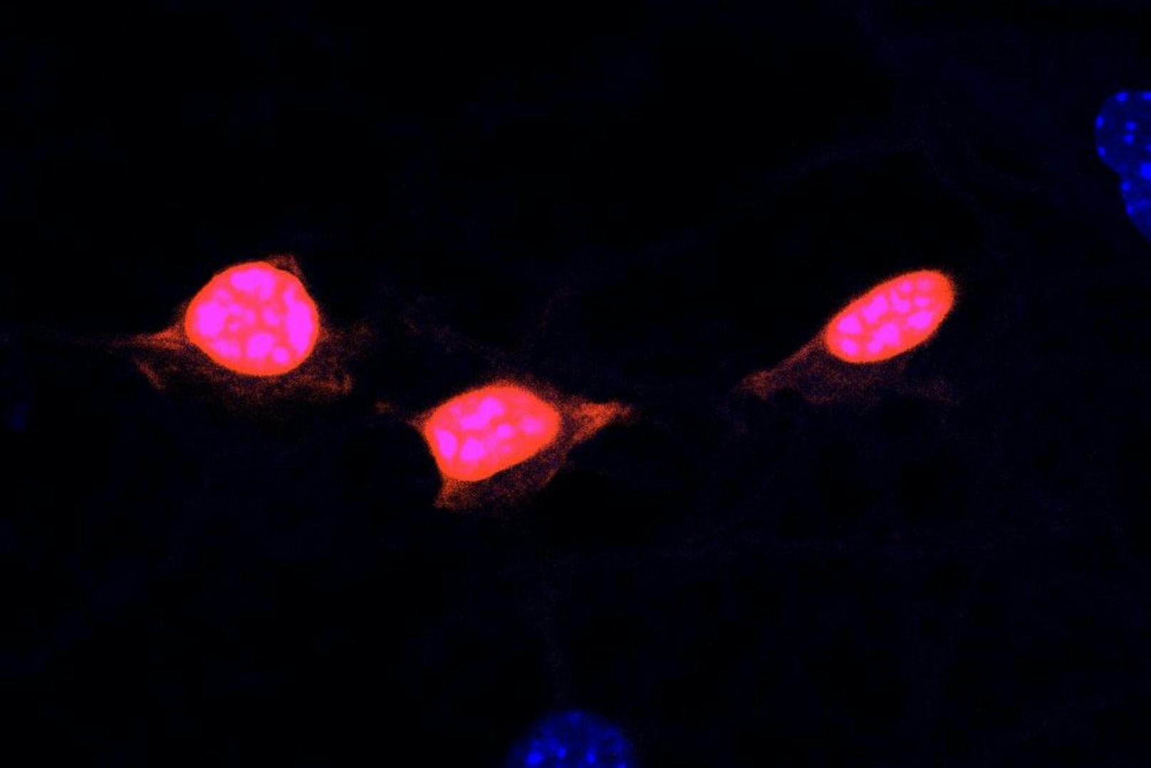 Neuronen, die mit einer Art von Adeno-assoziiertem Virus (AAV2) infiziert sind. AAV2 bringt die Neuronen im Gehirn einer Maus dazu, ein Protein zu produzieren, das unter einem bestimmten Licht rot leuchtet. Das Protein sammelt sich im Zellkern der Neuronen. Ein weiterer Farbstoff färbt alle Zellkerne blau. Das Bild zeigt, dass der Farbstoff die Kerne aller Zellen einfärbt, das Virus aber nur die Neuronen infiziert.