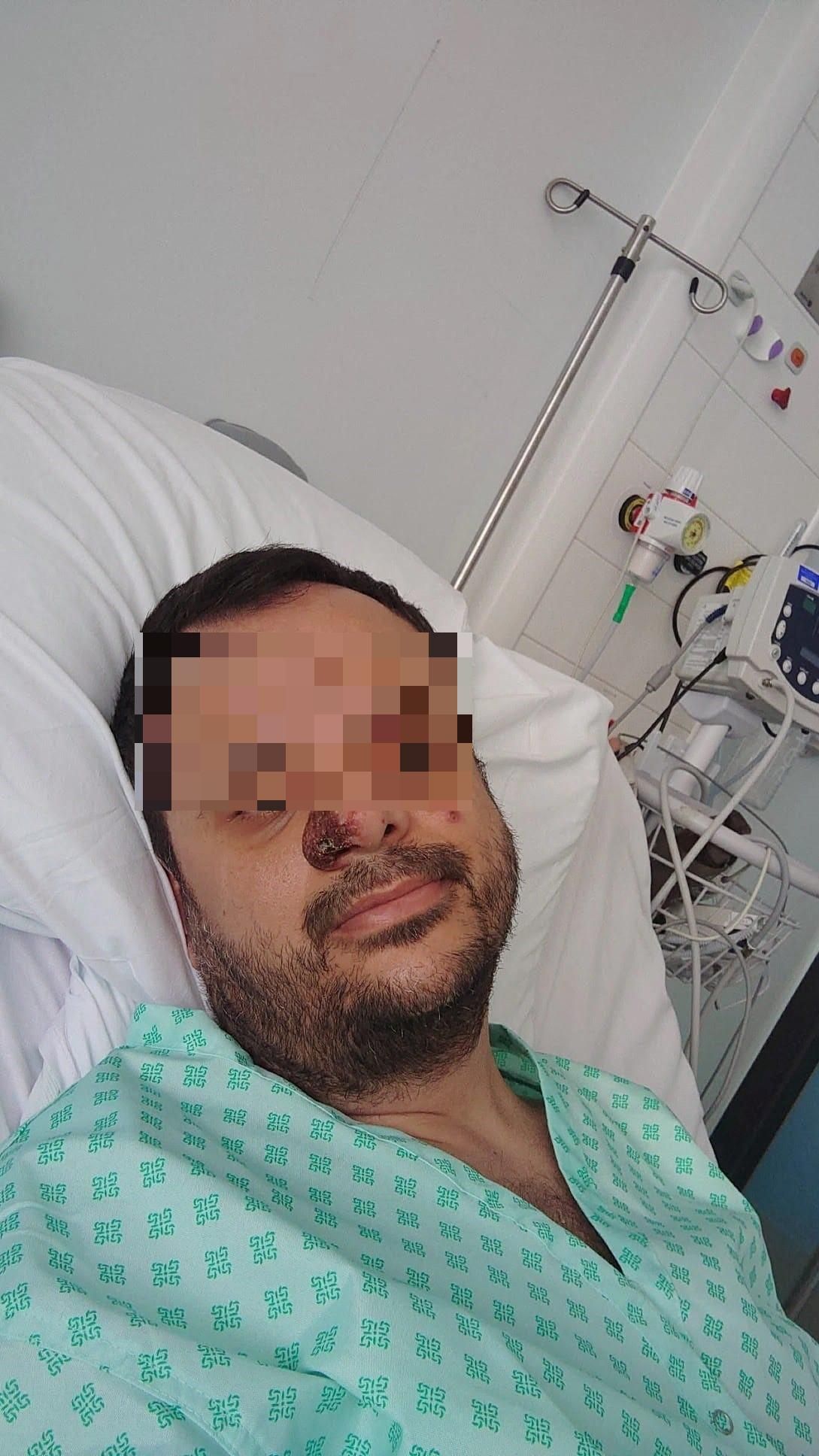 Die Weltgesundheitsorganisation (WHO) hat am 23. Juli 2022 den Affenpocken-Ausbruch in mehr als 50 Ländern zu einer 