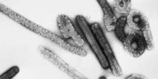 Neun Tote – WHO warnt vor gefährlichem Marburg-Virus