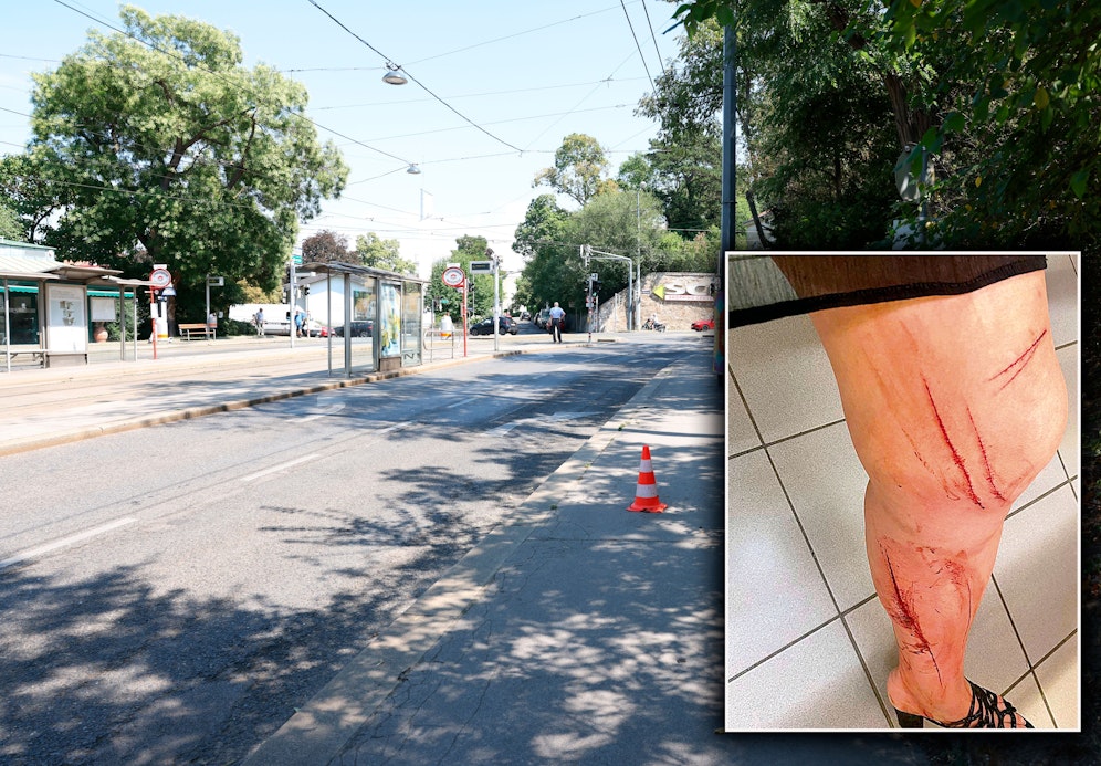 Die Attacke ereignete sich laut der Betroffenen in der&nbsp;Billrothstraße in Wien-Döbling, gegenüber der Straßenbahnstation 38 und 39A.