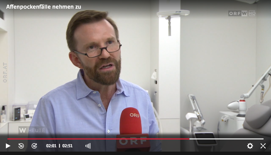 Hautarzt Gerold Felician Lang sagt im ORF-Interview, mit welcher Situation er im Hinblick auf die Affenpocken rechnet.