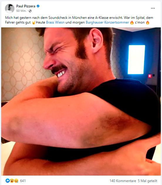 Paul Pizzera schildert, dass er sich bei einem Unfall verletzt hatte. Laut seinem Management ein Scherz.