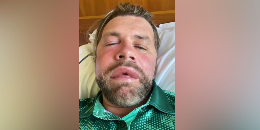Brian McFadden liegt im Spital.
