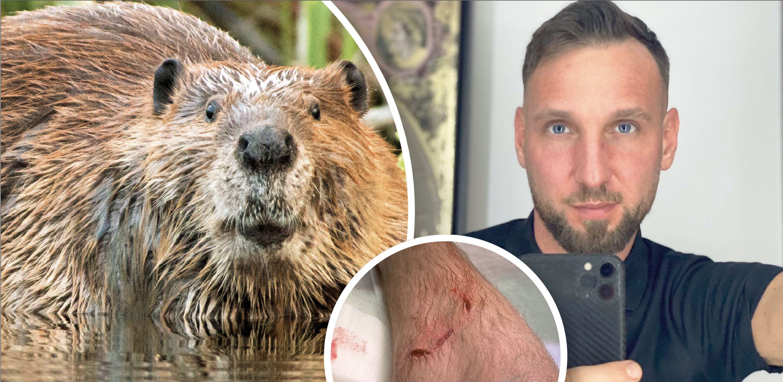 Mario K. (32) wurde beim Baden in Wien von einem Biber ins rechte Bein gebissen.