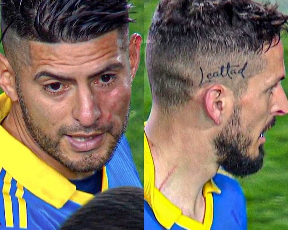 Carlos Zambrano und Dario Benedetto prügelten sich in der Halbzeitpause. 