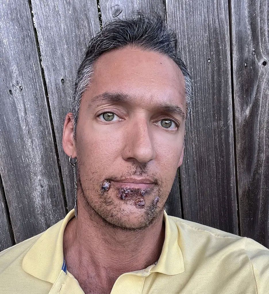 Der 40-jährige Pornostar weiß bis heute nicht, wo oder wann er sich angesteckt hat.