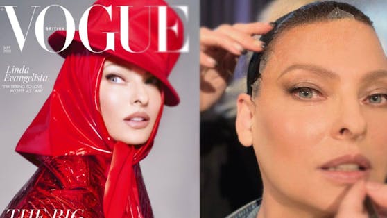 Linda Evangelista hatte 2015 ein entstellendes Beauty-Treatment. Für "Vogue" wurde ihre Gesicht wieder in die ursprüngliche Position "getaped".