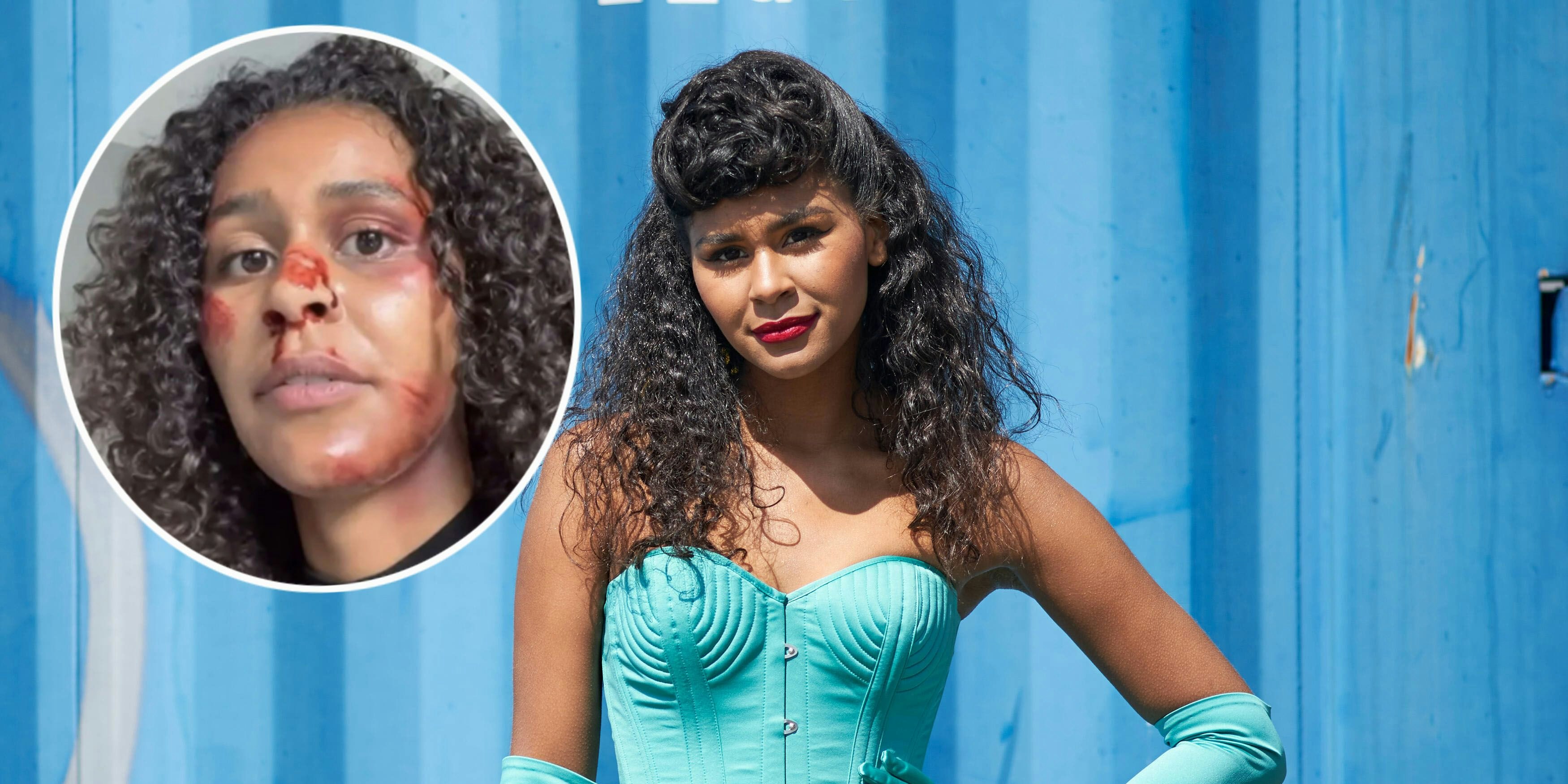 Lijana Kaggwa nahm 2020 bei "GNTM" teil, doch verließ die Sendung freiwillig.