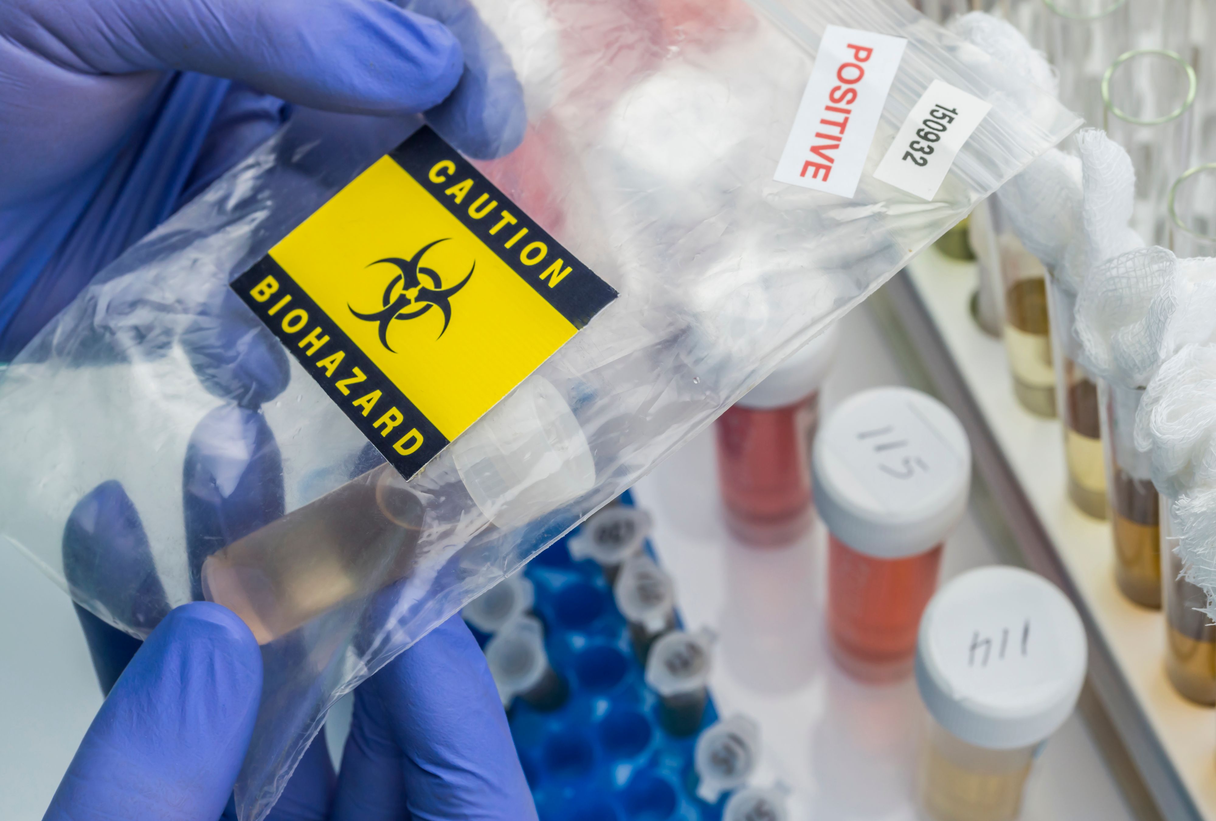 Chemikalien für russische Kampfstoffe? Ermittlungen gegen ein&nbsp;Unternehmen aus Norddeutschland laufen