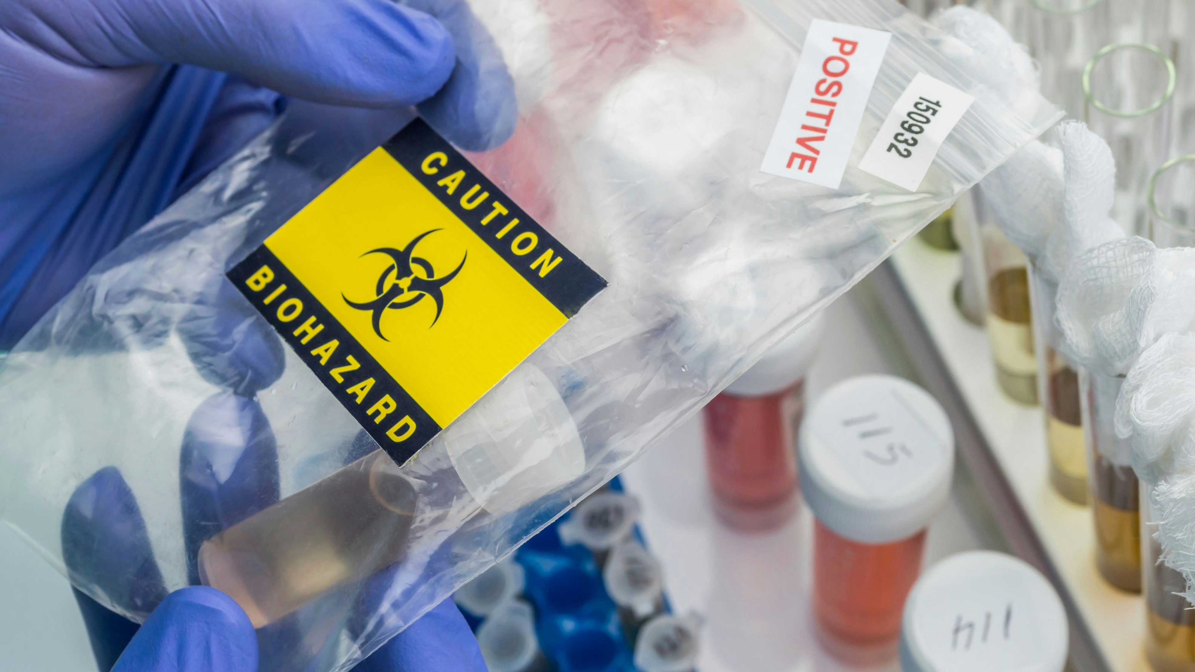 Scientist checks sample of Covid-19 in a biohazard bag, conceptual image