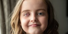8-Jährige hat nach Krebserkrankung "magisches Auge"