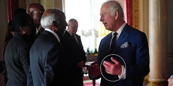 Die Hände von König Charles III. sehen geschwollen aus.