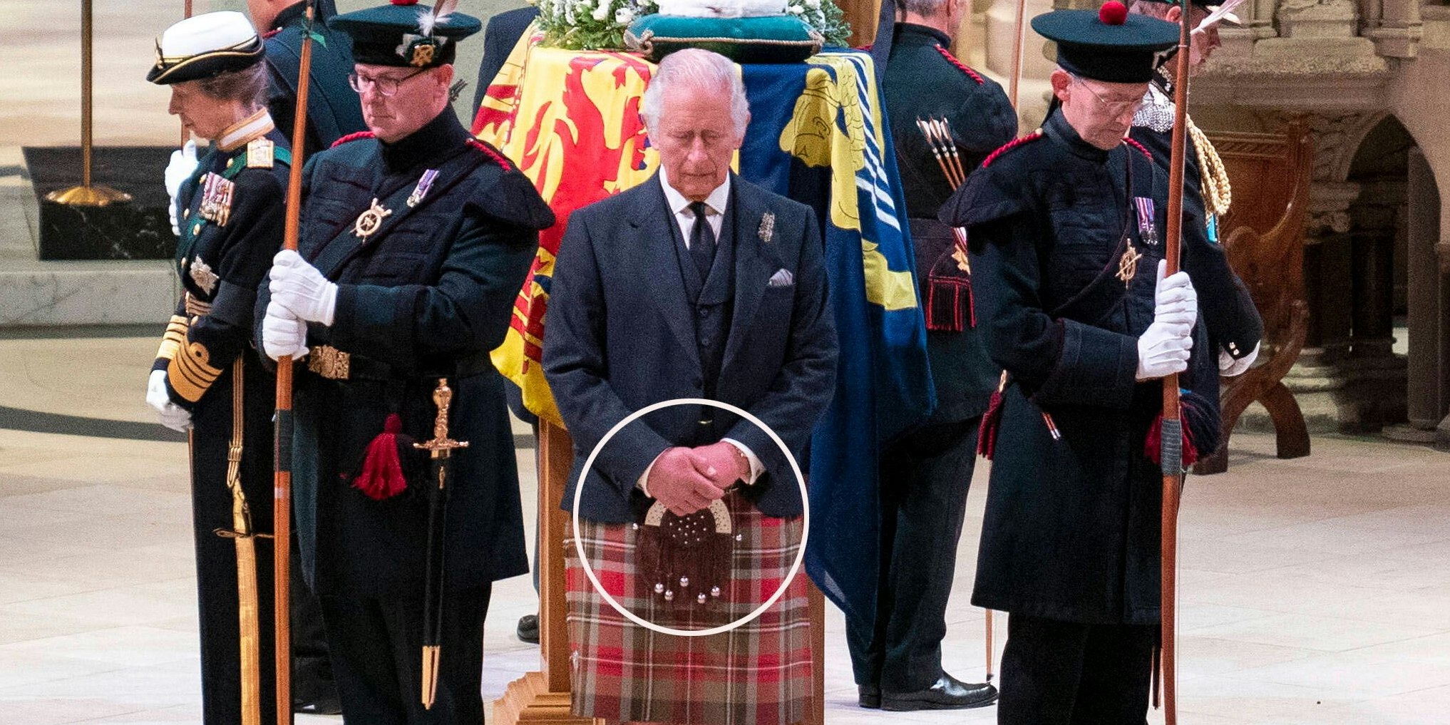 Charles' Finger sehen auffällig dick aus.