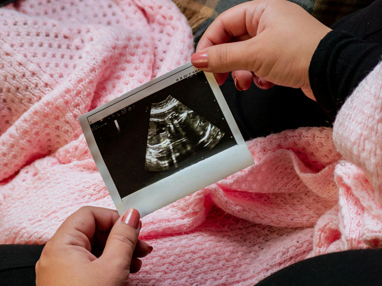 Schwangere Frauen in Ungarn müssen bei der Entscheidung zur Abtreibung eine weitere Prozedur über sich ergehen lassen.