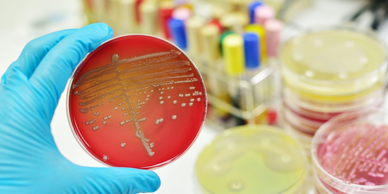 Bakterien in der Petrischale: Diphtherie wird über Tröpfchen übertragen.