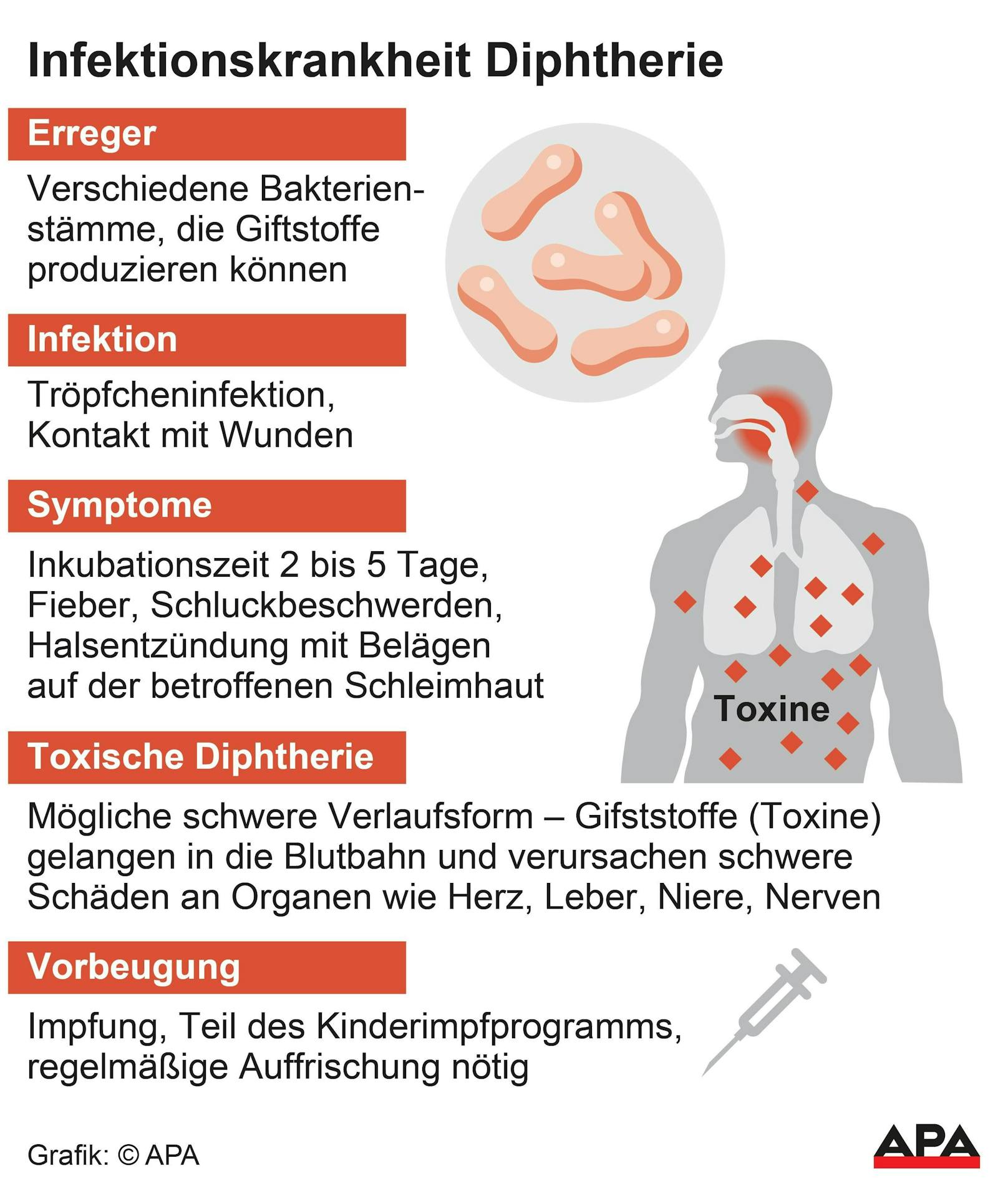 Derzeit sind 17 Diphtherie-Fälle in Österreich bekannt.