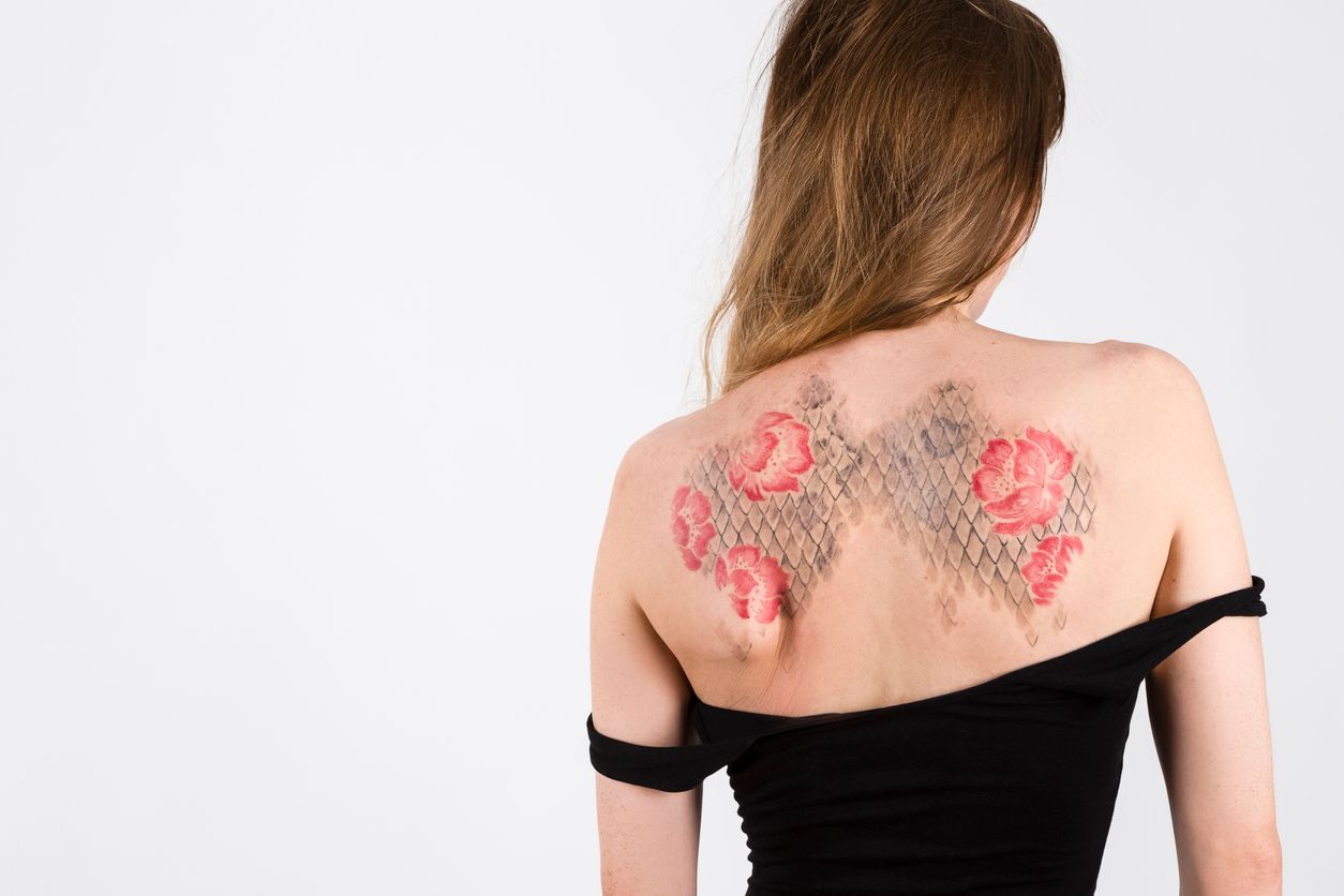 Sind Patch-Tattoos dauerhaft?