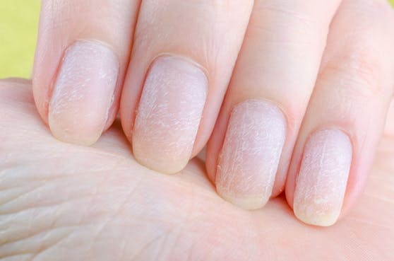 Auch bei den schönsten Nageldesigns gibt es einige Gefahren vor denen deine Nägel nicht sicher sind.