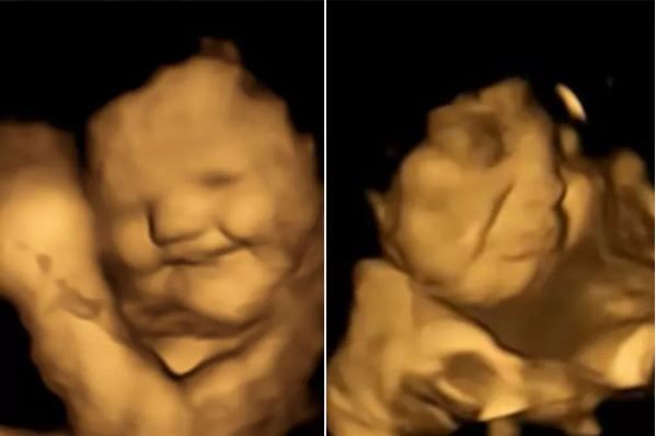 Links die lachende Reaktion nach Karotten, rechts der Schmollmund nach Kohl.