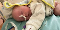 Vier Wochen altes Baby Elina kämpft ums Überleben