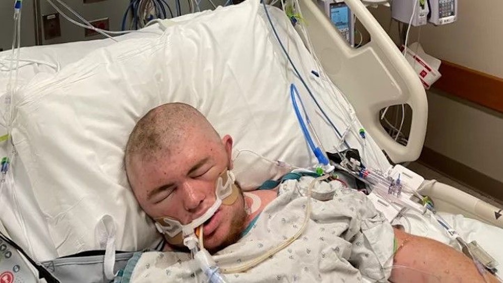 Austin Bellamy musste in ein künstliches Koma versetzt werden.