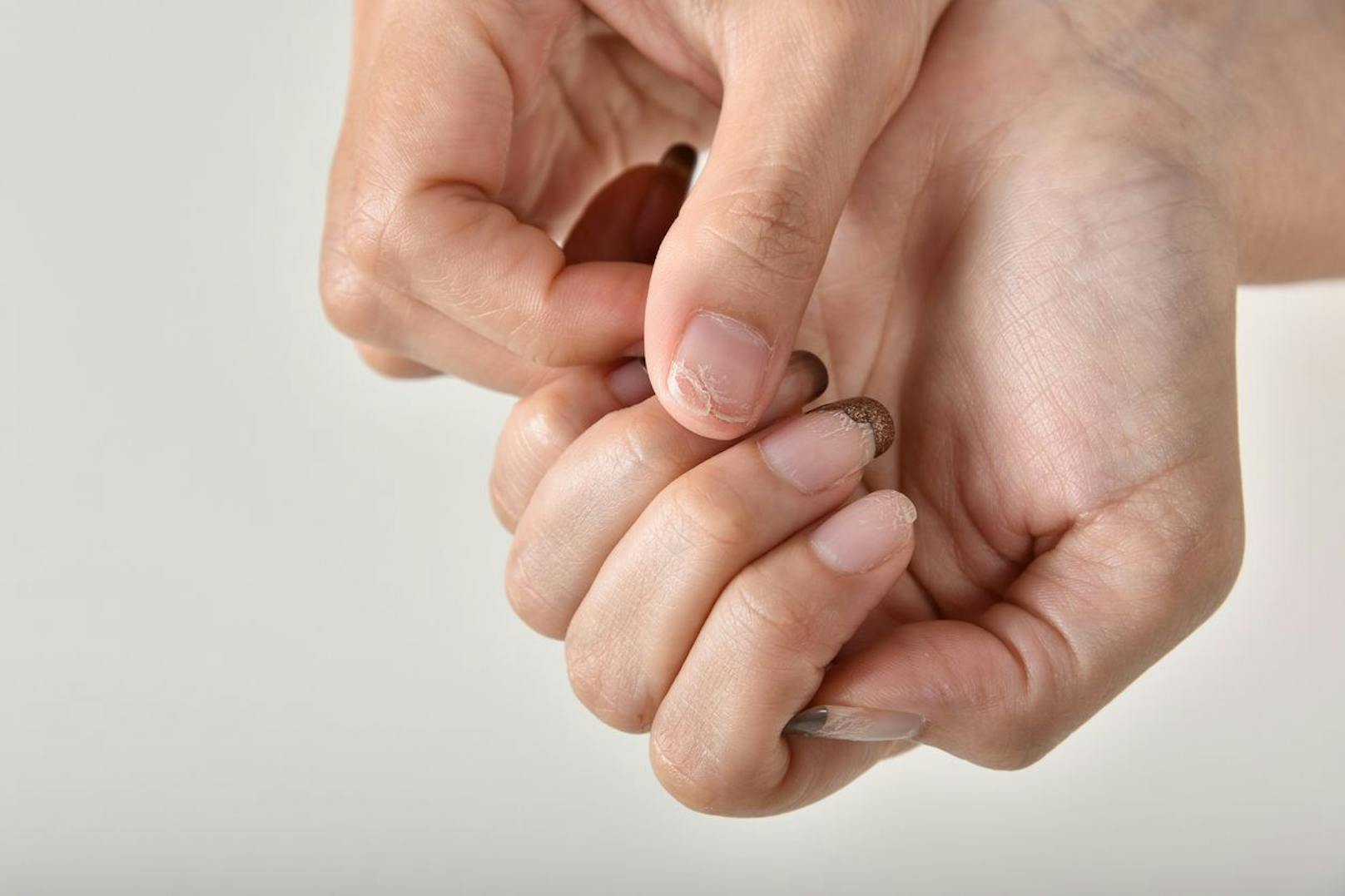Mit einigen Tipps schaffst du es deine geschwächte Nagelplatte so zu stärken, dass Spliss und Splitter keine Chance haben.
