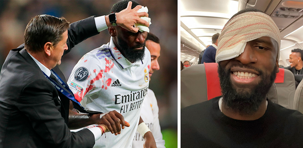 Antonio Rüdiger zeigt seinen Turban. 