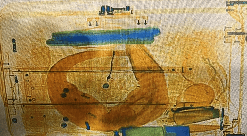 Wegen dieses Röntgenbildes wurden die Beamten stutzig. 