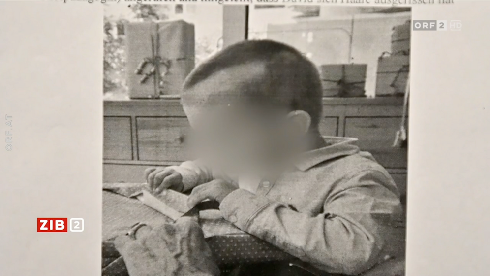 Als der Vierjährige aus dem Kindergarten kam, war auf seinem kopf eine erschütternd große, kahle Stelle – später sprach er von der Gewalt, die ihm durch eine Kindergarten-Assistentin angetan worden sei.