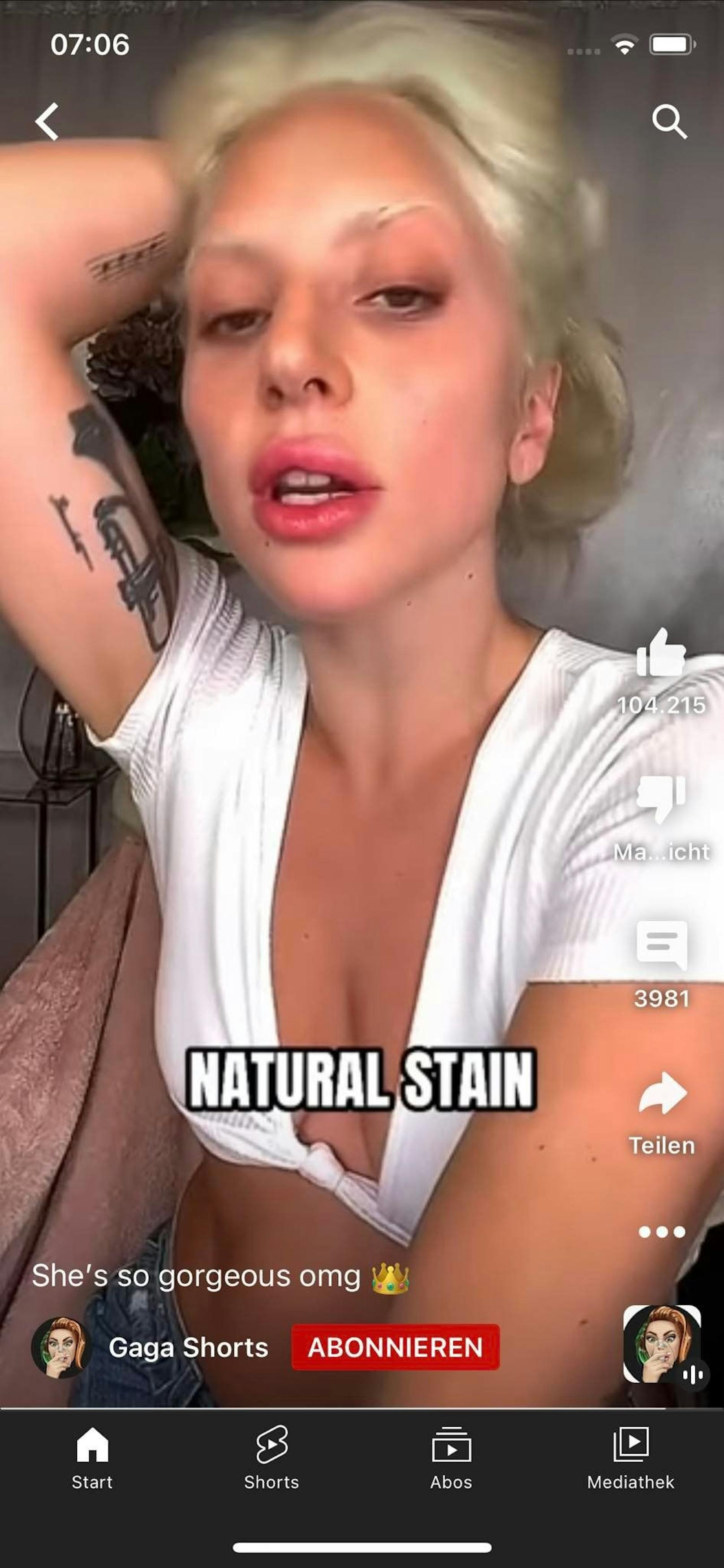 Lady Gaga zeigte sich kürzlich auf YouTube mit riesengroßem Schmollmund. Die Folge von zu viel Filler? 