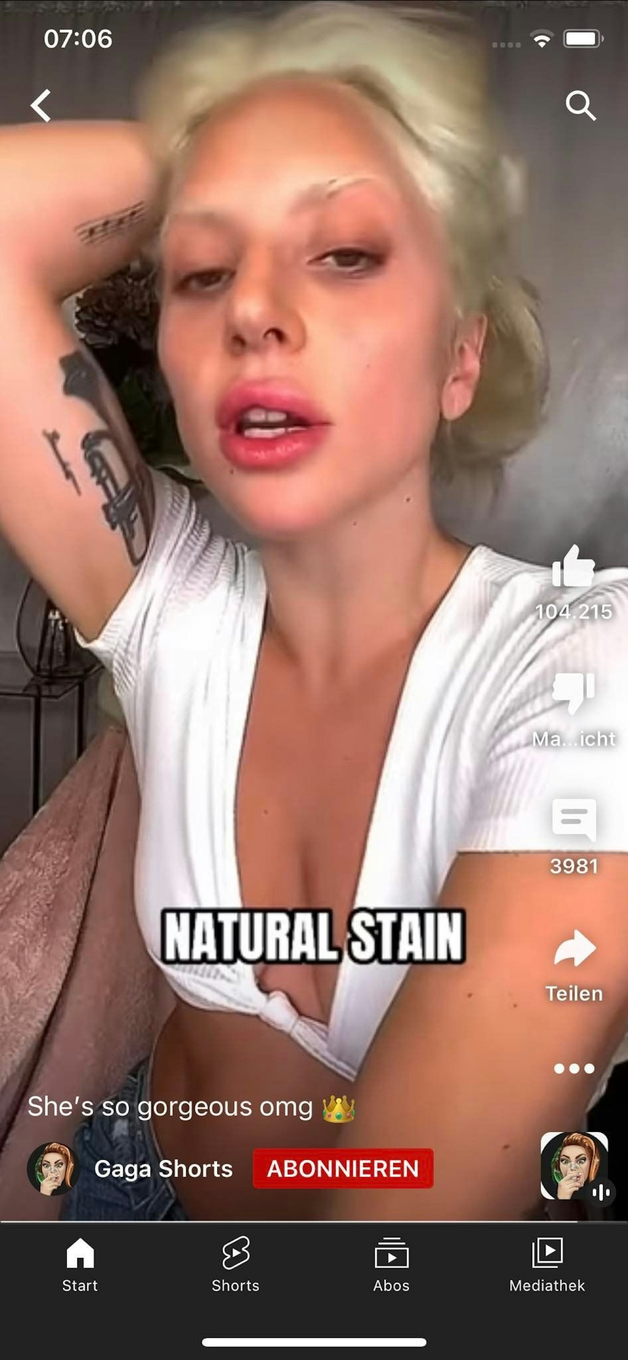 Heute.at - Bei Lady Gaga ging die dicke Lippe gehörig schief