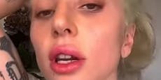 Bei Lady Gaga ging die "dicke Lippe" gehörig schief