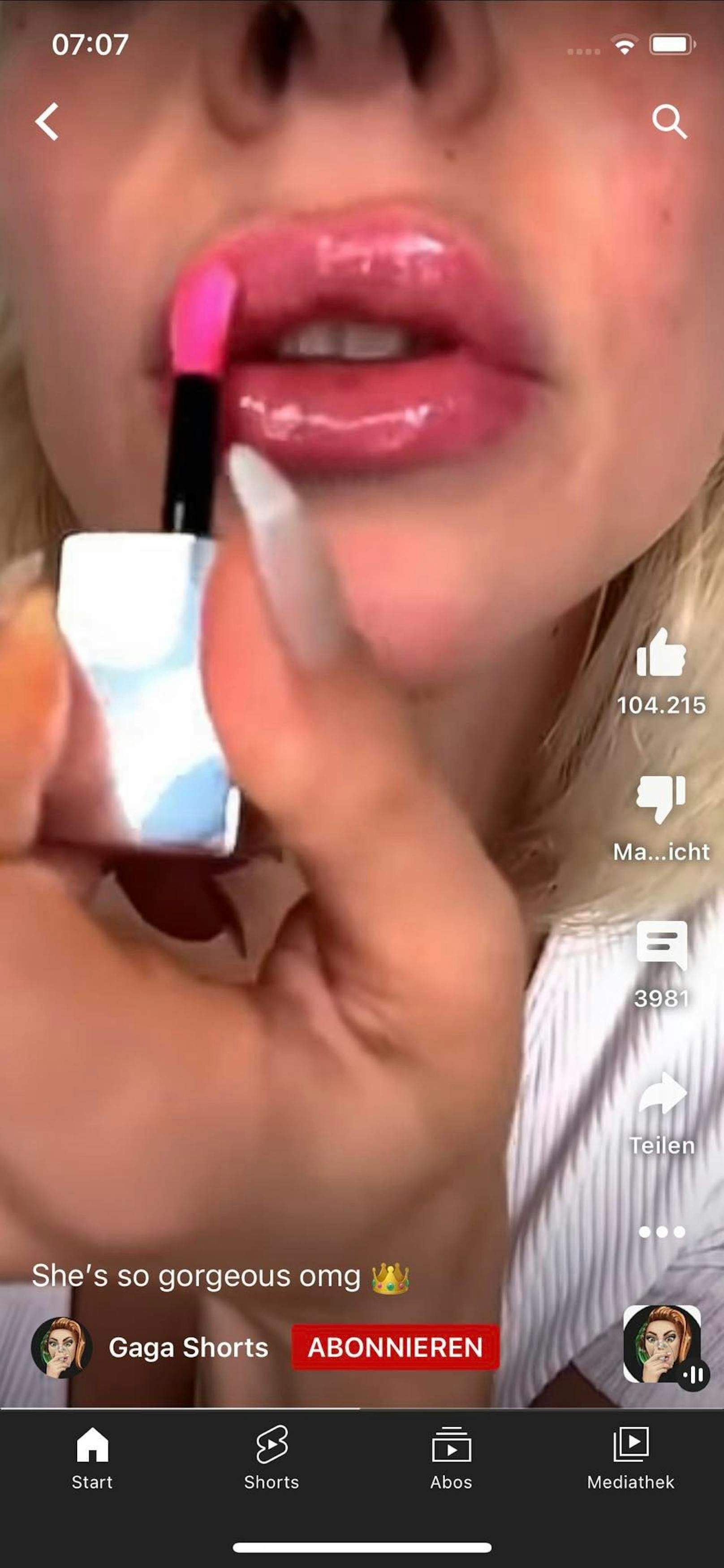 Als sie ihren neuen Lip Gloss ihren Fans präsentiert, sieht man, dass der Lipfiller überhand genommen hat und sich offensichtlich bereits außerhalb der Lippenhaut befindet.