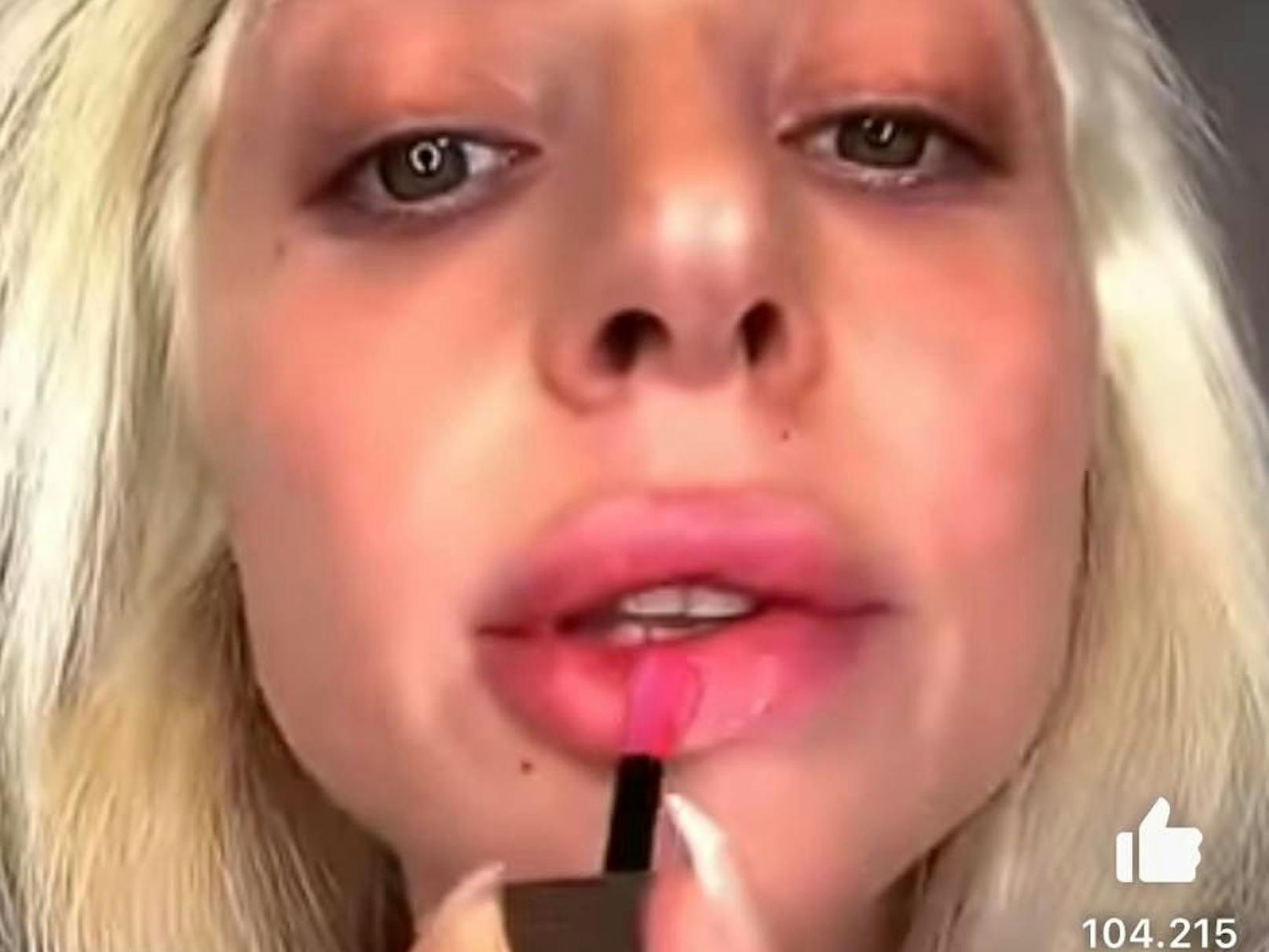 Lady Gaga zeigte sich kürzlich auf YouTube mit riesengroßem Schmollmund. Die Folge von zu viel Filler? 