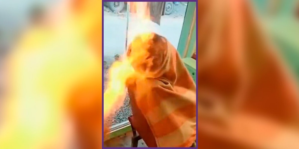 Der Bursche erlitt schwere Verbrennungen am Hals und an der Brust, sein derzeitiger Zustand ist unklar.