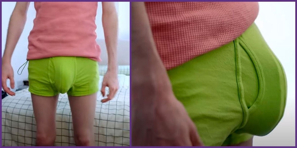 24 Zentimeter misst Joes Penis. Deshalb muss er spezielle Unterwäsche tragen.