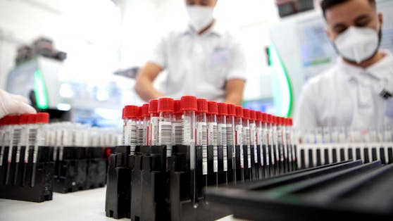 Derzeit sind pro Person fünf PCR-Tests und fünf Antigen-Schnelltests pro Monat kostenlos.
