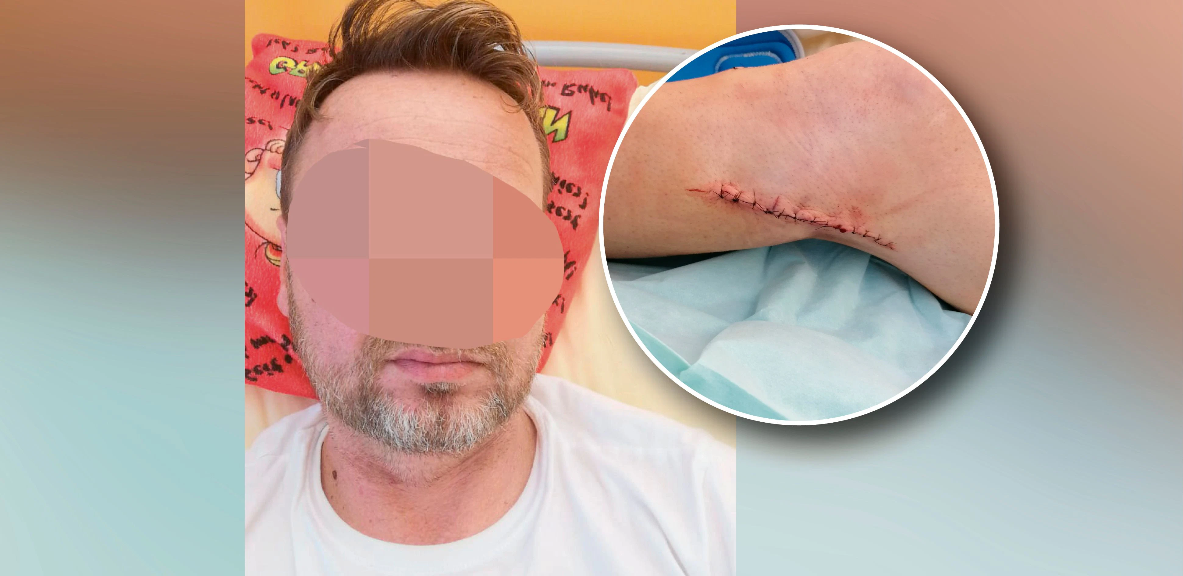 45-Jähriger wurde bei Festnahme schwer verletzt