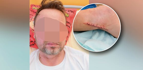 Ein 45-jähriger Beamter wurde bei einer laut ihm völlig überzogenen Festnahme schwer verletzt, musste sogar operiert werden.