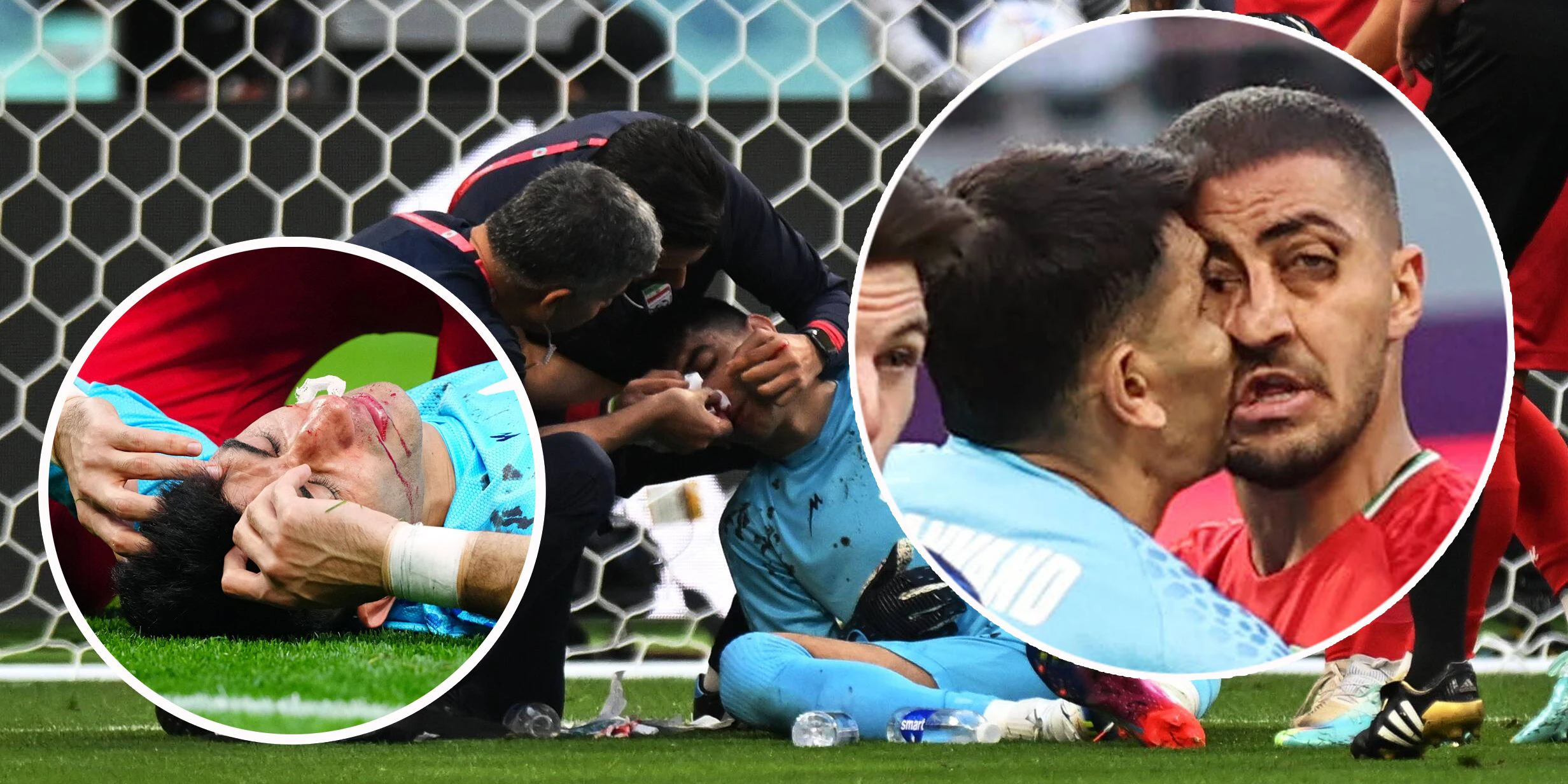 Alireza Beiranvand verletzt sich bei diesem Crash schwer am Kopf.