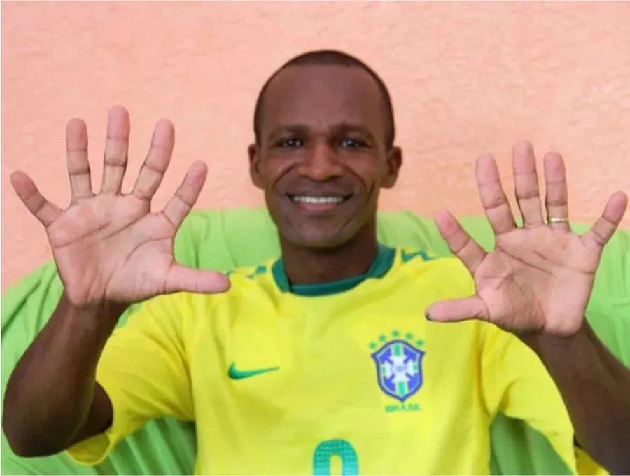 Josevaldo de Almeida Thome hat sechs Finger, er hofft auf den sechsten Titel von Brasilien. 