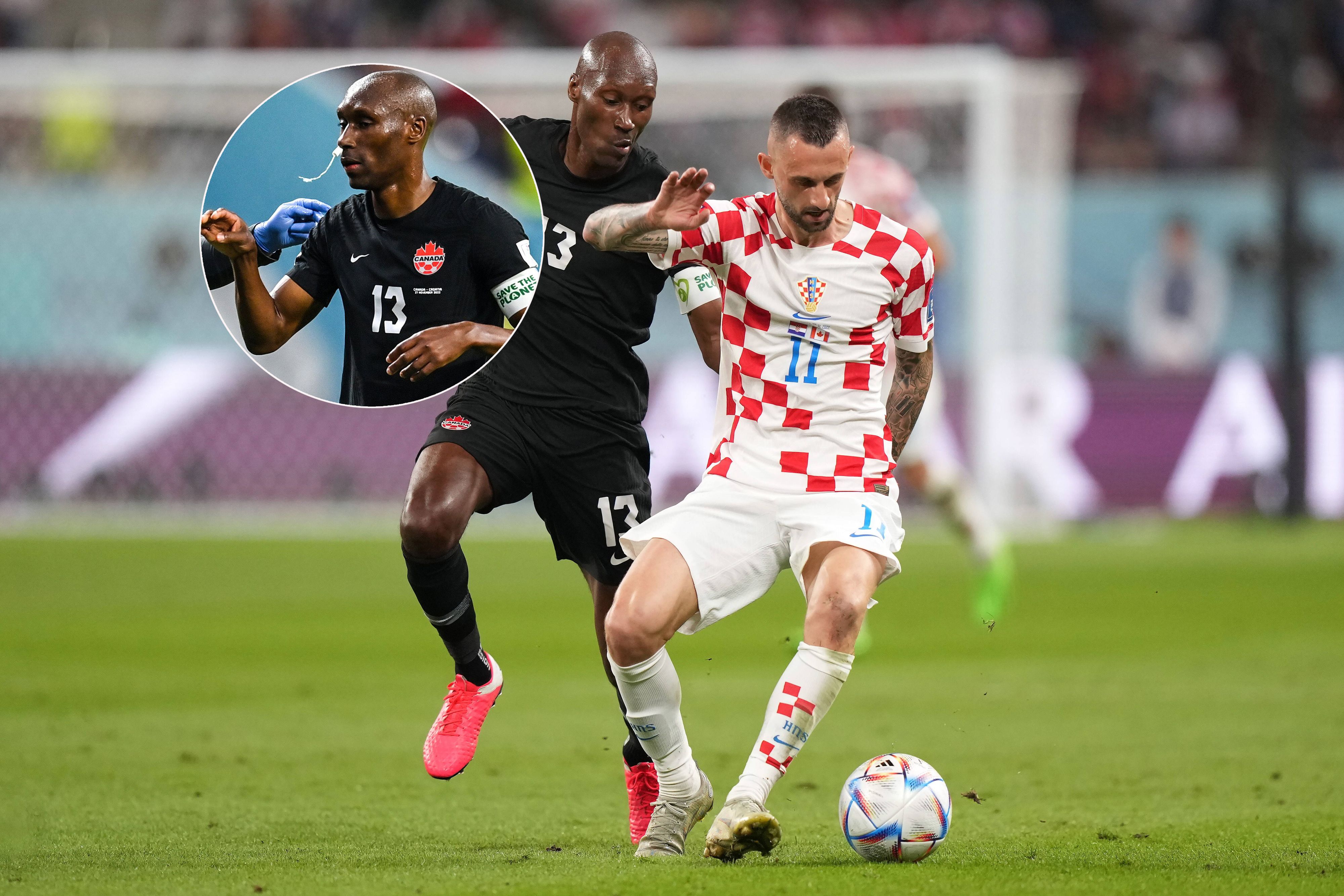 Atiba Hutchinson blutete aus der Nase, ein Tampon schuf Abhilfe.