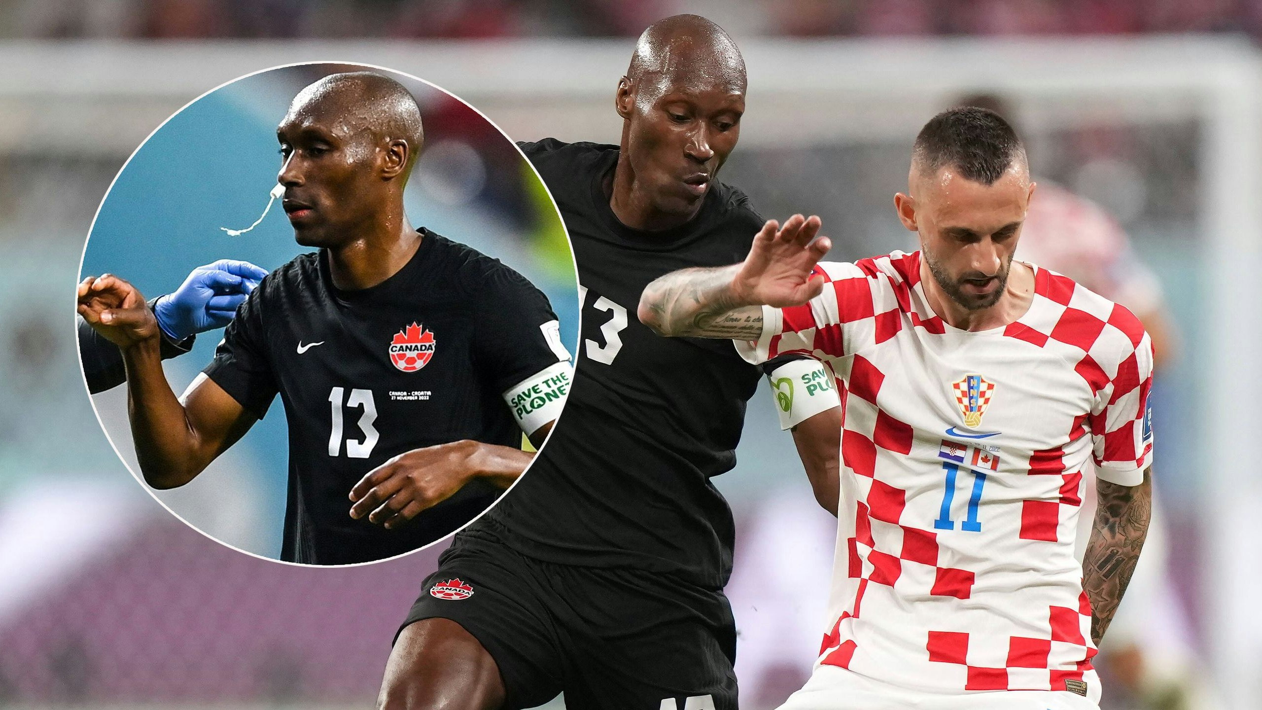 Atiba Hutchinson blutete aus der Nase, ein Tampon schuf Abhilfe.